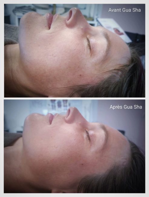 Avant/Après un Massage visage Gua Sha en Ariege à Surba avec Mélanie Dupuis Phytoréflexologue